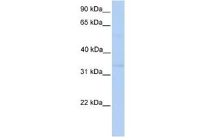 WB Suggested Anti-NDE1 Antibody Titration: 0.