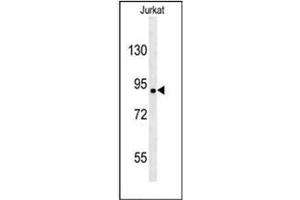 Western blot analysis of KIAA1680 Antibody (C-term) in Jurkat cell line lysates (35ug/lane). (MGC48628 (AA 787-816), (C-Term) Antikörper)