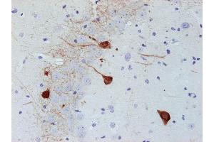 Immunostaining of paraffin embedded section of mouse brain (dilution 1 : 500). (PVALB Antikörper)