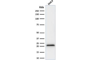 Western Blot Analysis of human HeLa cell lysate using p21 Mouse Recombinant Monoclonal Antibody (rCIP1/823).