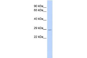 WB Suggested Anti-TRIM55 Antibody Titration:  0. (TRIM55 Antikörper  (Middle Region))