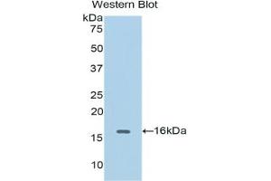 Detection of Recombinant CDK1, Human using Polyclonal Antibody to Cyclin Dependent Kinase 1 (CDK1) (CDK1 Antikörper  (AA 59-182))