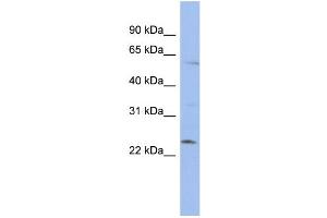 WB Suggested Anti-ZNF239 Antibody Titration:  0. (ZNF239 Antikörper  (N-Term))