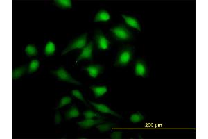 Immunofluorescence of monoclonal antibody to NME1 on HeLa cell. (NME1 Antikörper  (AA 1-152))