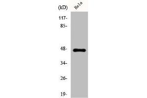 Western Blot analysis of HeLa cells using Cytokeratin 20 Polyclonal Antibody (Keratin 2 Antikörper  (C-Term))
