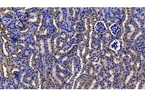Detection of ORM2 in Mouse Kidney Tissue using Polyclonal Antibody to Orosomucoid 2 (ORM2)