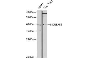 Western blot analysis of extracts of various cell lines, using NDUF antibody (ABIN6128985, ABIN6144470, ABIN6144471 and ABIN6222949) at 1:1000 dilution.