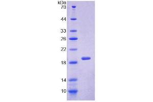 SDS-PAGE (SDS) image for Sorcin (SRI) (AA 29-169) protein (His tag) (ABIN6237860) (SRI Protein (AA 29-169) (His tag))