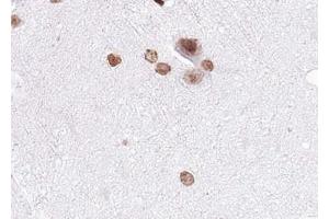 ABIN6267530 at 1/100 staining human brain tissue sections by IHC-P. (MAP2K4 Antikörper  (pSer80))