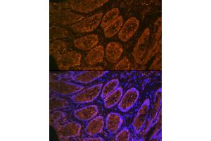 Immunofluorescence analysis of rat rectum cells using CE Rabbit mAb (ABIN7266085) at dilution of 1:100 (40x lens). (CEACAM6 Antikörper)