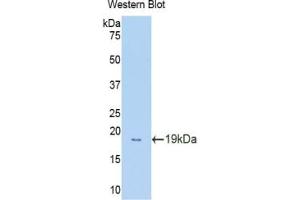 Western blot analysis of the recombinant protein. (Glucocorticoid Receptor Antikörper  (AA 622-755))