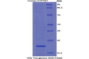 SDS-PAGE analysis of Human Cytochrome P450 1B1 Protein.