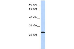 WB Suggested Anti-NKAIN4 Antibody Titration: 0. (NKAIN4 Antikörper  (N-Term))