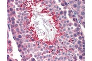 IHC Image for AP22588PU-N Mouse Testis (formalin-fixed, paraffin-embedded) stained with M6PRBP1followed by biotinylated anti-goat IgG secondary antibody LS-D3, alkaline phosphatase-streptavidin and chromogen. (PLIN3 Antikörper  (Internal Region))
