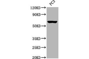 Western Blot Positive WB detected in:PC3 whole cell lysate All lanes: Muscarinic Acetylcholine Receptor M3 antibody at 1:2000 Secondary Goat polyclonal to rabbit IgG at 1/50000 dilution Predicted band size: 67 kDa Observed band size: 67 kDa (Rekombinanter CHRM3 Antikörper)