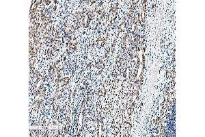 anti-CCAAT/enhancer Binding Protein (C/EBP), beta (CEBPB) (AA 1-200) antibody