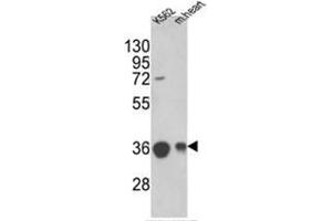 Western blot analysis of MDH2 Antibody (Center) in K562 cell line and mouse heart tissue lysates (35ug/lane). (MDH2 Antikörper  (Middle Region))