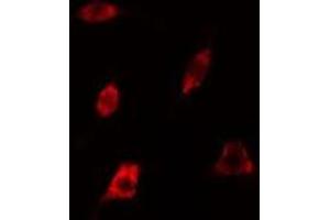 ABIN6278624 staining 293 cells by IF/ICC. (RAB35 Antikörper  (Internal Region))