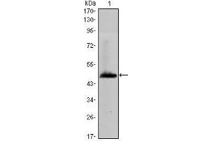 Western Blot showing HAS1 antibody used against human HAS1 (AA: 74-243) recombinant protein. (HAS1 Antikörper)