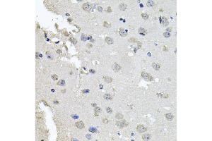 Immunohistochemistry of paraffin-embedded mouse brain using PKN1 antibody. (PKN1 Antikörper)