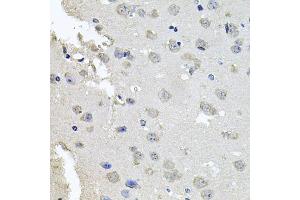 Immunohistochemistry of paraffin-embedded mouse brain using PKN1 antibody.