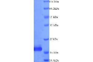 SDS-PAGE (SDS) image for TIMP Metallopeptidase Inhibitor 4 (TIMP4) (AA 30-224), (full length) protein (His tag) (ABIN7478924)