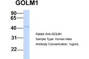 Host: Rabbit Target Name: GOLM1 Sample Type: Human Hela Antibody Dilution: 1.