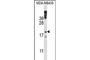 HIST1H1E Antibody (N-term) (ABIN657633 and ABIN2846629) western blot analysis in MDA-M cell line lysates (35 μg/lane). (HIST1H1E Antikörper  (N-Term))
