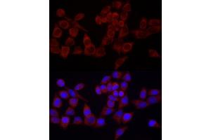 Immunofluorescence analysis of HeLa cells using SRP72 Rabbit pAb (ABIN6134166, ABIN6148452, ABIN7101299 and ABIN7101300) at dilution of 1:100 (40x lens). (SRP72 Antikörper)