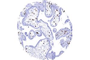 Immunohistochemistry (IHC) image for anti-Ionized Calcium-binding Adapter Molecule 1 (IBA1) (AA 1-146) antibody (ABIN7477371)