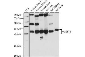 Western blot analysis of extracts of various cell lines, using GSTT2 antibody (ABIN7267449) at 1:1000 dilution.