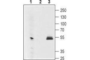 Western blot analysis using Mouse Anti-GIRK1 (Kir3. (KCNJ3 Antikörper  (Extracellular Loop))