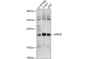 Western blot analysis of extracts of various cell lines, using NTPCR antibody (ABIN7269059) at 1:1000 dilution. (C1orf57 Antikörper  (AA 91-190))