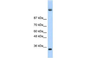 DAZ4 antibody used at 1 ug/ml to detect target protein. (DAZ4 Antikörper  (N-Term))
