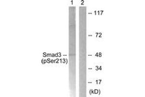 Western blot analysis of extracts from HT29 cells, using Smad3 (Phospho-Ser213) Antibody. (SMAD3 Antikörper  (pSer213))