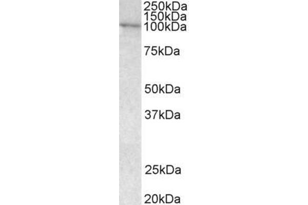 VAV3 Antikörper  (Internal Region)