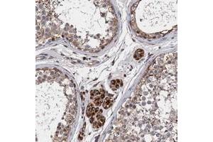 Immunohistochemical staining of human testis with CNNM1 polyclonal antibody  shows moderate cytoplasmic positivity in cells in seminiferus ducts and strong positivity in Leydig cells. (Cyclin M1 Antikörper)