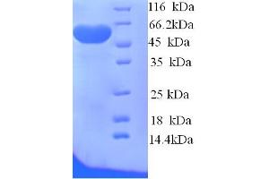 SDS-PAGE (SDS) image for Sulfite Oxidase (SUOX) (AA 1-416), (full length) protein (His tag) (ABIN5714478) (SUOX Protein (AA 1-416, full length) (His tag))