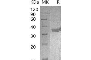 Western Blotting (WB) image for Carbonic Anhydrase IV (CA4) (AA 18-277) protein (His tag) (ABIN7320479) (CA4 Protein (AA 18-277) (His tag))