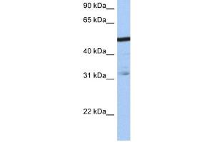 WB Suggested Anti-ZFAntibody Titration:  0. (ZFP14 Antikörper  (N-Term))
