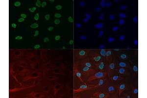 Immunofluorescence of Histone H3 K27me3 Antibody. (Histone 3 Antikörper  (H3K27me3))