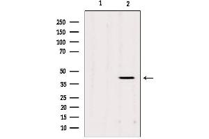 Western blot analysis of extracts from Mouse cancer, using AGPAT3 Antibody. (AGPAT3 Antikörper  (Internal Region))