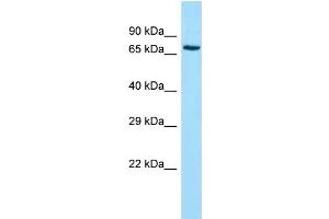 Host: Rabbit Target Name: ADCK2 Sample Type: Jurkat Whole Cell lysates Antibody Dilution: 1. (ADCK2 Antikörper  (Middle Region))