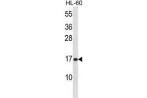 Western blot analysis in HL-60 cell line lysates (35ug/lane) using PLA2G5  Antibody (C-term). (PLA2G5 Antikörper  (C-Term))