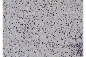 ABIN6278217 at 1/100 staining Human liver tissue by IHC-P. (SOX1 Antikörper  (Internal Region))