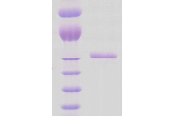 HSPD1 Protein (partial)