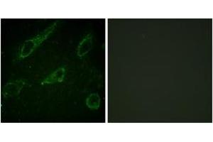 Immunofluorescence analysis of HeLa cells, using c-Abl (Phospho-Tyr245) Antibody.
