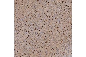 IHC analysis of SNRPA1 using anti-SNRPA1 antibody (ABIN7599131). (SNRPA1 Antikörper  (AA 1-233))