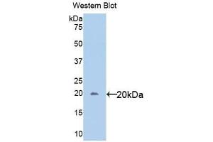 Detection of Recombinant gp130, Human using Polyclonal Antibody to Glycoprotein 130 (gp130) (CD130/gp130 Antikörper  (AA 392-566))