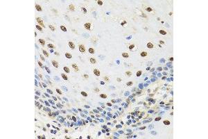 Immunohistochemistry (Paraffin-embedded Sections) (IHC (p)) image for anti-TAF15 RNA Polymerase II, TATA Box Binding Protein (TBP)-Associated Factor, 68kDa (TAF15) (AA 1-280) antibody (ABIN6148818)
